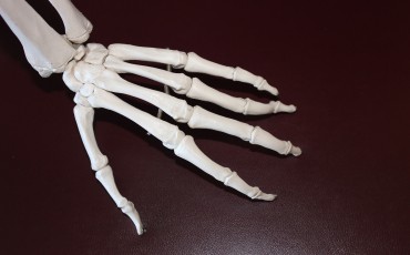Bones Skeleton Arthritis Arthritis Awareness Month