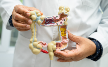 Doctor holding model of the digestive tract