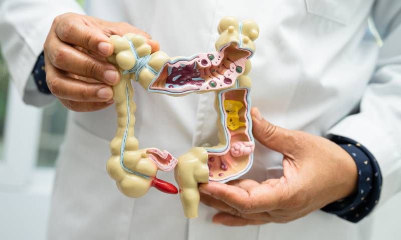 Doctor holding model of the digestive tract